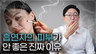 담배가 피부에 안 좋은 진짜 이유 전자담배 포함 ㅣ 피부과전문의 [upl. by Mikey]