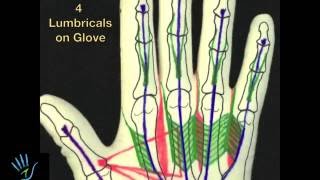 Drawing of Lumbricals on the Anatomy Glove [upl. by Llebyram]