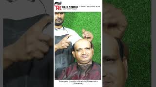 hair patch fixing in men Bangalorehairreplacment hairfixing hairstyle nonsurgicalhairreplacement [upl. by Genna417]