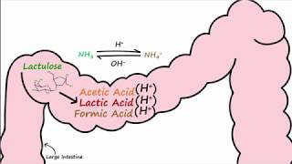 Hepatic Encephalopathy and Lactulose [upl. by Yrram]