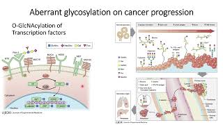 OGlcNAcylation and Aberrant glycosylation in pancreatic cancer tumor progression Code 369 [upl. by Monk661]