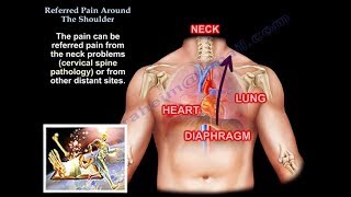 Referred Pain Around The Shoulder  Everything You Need To Know  Dr Nabil Ebraheim [upl. by Eartnoed]