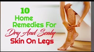 10 HOME REMEDIES FOR DRY and SCALY SKIN ON LEGS  HEALTHY LIFESTYLE [upl. by Anirad396]