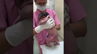 Neonatal early STEPPING Reflex [upl. by Ynos]