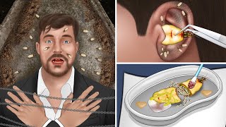 ASMR Remove queen termite from MrBeasts ear  Ear Cleaning Animation [upl. by Achorn]