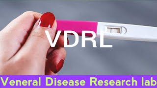 VDRL  Veneral disease Research lab test  what is VDRL  how to test VDRL  lab test Syphilis [upl. by Gothurd]