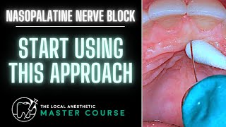 How to Do A Nasopalatine Nerve Block  Online Dental Continuing Education  LocalAnestheticcom [upl. by Berhley]