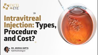 Intravitreal Injection Types Procedure and Cost Dr Anisha Gupta  Eye Specialist Delhi Excel Eye [upl. by Naehs998]