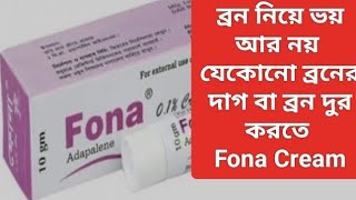 Fona Cream । Fona cream এর কাজ কি । মুখের ব্রনের দাগ ও মেছতা দুর করার ক্রিম [upl. by Leirbaj]