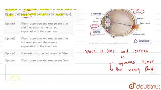 Assertion  Aqueous humor is a transparent get like fluid Reason  Vitreous humor [upl. by Einafets]