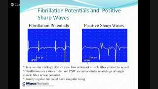 Intro to Electrodiagnostic Studies [upl. by Innor290]