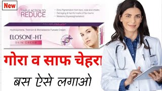 Elosone ht Skin Cream Kaise Use kare  Elosone ht skin cream side effects [upl. by Gelya]