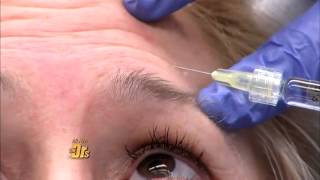 The DRs Show Watch how Belotero changes your under eye appearance [upl. by Nileve760]