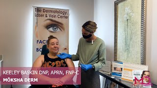 Treating an Acne Lesion at Mōksha Derm [upl. by Nogem]