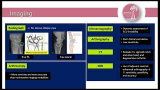 TFCC injury amp DRUJ instability [upl. by Aronael]