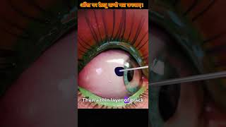 आँख पर टैट्यू कभी मत बनवाए।shorts viral facts eyes [upl. by Courtnay]