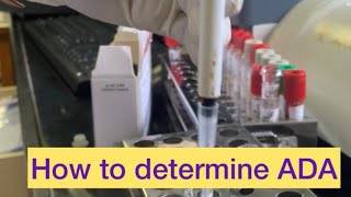 Adenosine Deaminase test for Tuberculosis [upl. by Illa]