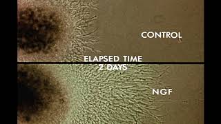 8 Response of Cells to Nerve Growth Factor NGF [upl. by Seyah565]