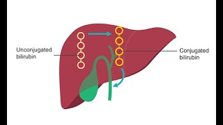 Analyzing liver function–How to use lab values [upl. by Letsirhc412]