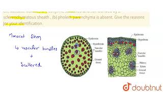 Identify the plant material which shows the following anatomical features  a the vascular bun [upl. by Malory]