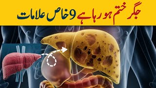 LIVER is DYING 9 Weird Signs Of Liver Damage  Dr YK [upl. by Nnaerb15]