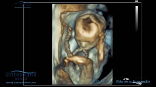 Scan of the Week 19 Week Advanced Early Scan  Ultrasound Ireland [upl. by Glyn]