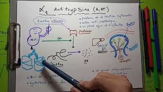 2 proteine plasmatique de linflammation  ALPHA 1 ANTITRYPSINE son déficit et emphysème [upl. by Mccartan]