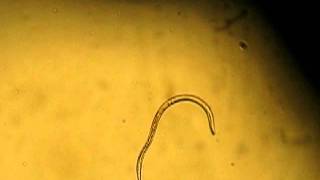 Strongyloides stercoralis filariform larvae [upl. by Sioled]