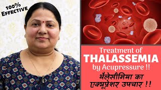 Treatment of THALASSEMIA by Acupressure  थैलेसीमिया का एक्यूप्रेशर उपचार [upl. by Arteid]