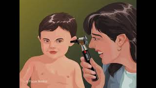 Otoscope  Otolaryngology [upl. by Trahern]