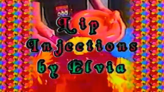 LIP INJECTIONS BY ELVIA [upl. by Nemrac]