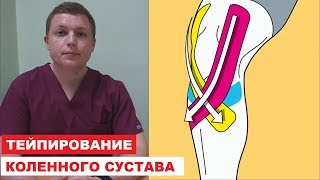 Боль в колене Тейпирование коленного сустава особенности применения тейплент Kinesiology Taping fo [upl. by Towroy]