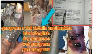 gangreen full details explanation hindenglish gasganreendrygangreenwetgangreenpathology treand [upl. by Bixby]