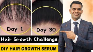 Powerful Hair Growth Serum For Extreme Hair Growth  Regrow Lost Hair Get Double Density in 30 days [upl. by Poul]