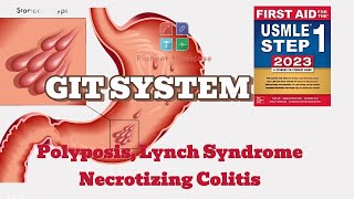 Polyposis Syndrome Lynch Syndrome Necrotizing Colitis first aid step 1USMLEUrduHindi [upl. by Wolford795]