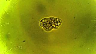 Ameba microscopio [upl. by Horton466]