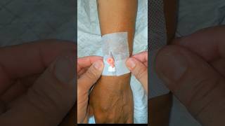 IV Cannulation subscribe cannula ivcannula health shortsindia [upl. by Netsrak]