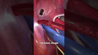 How liver transplant works copied [upl. by Vano341]