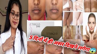 Ethiglo Soap Honest ReviewEthiglo Soap ph TestEthiglo Soap Benefits Usesampside effects review hindi [upl. by Aleetha]