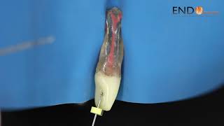 Odontometria em teoria [upl. by Annahsal]