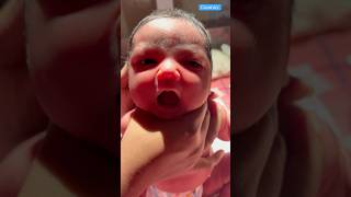 Cute Newborn Baby video medical viralshorts [upl. by Eilliw171]