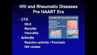 Biologics and HIV Infections Comorbidity and Therapy [upl. by Ursuline]