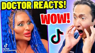 Plastic Surgeon Reacts to BOTCHED Plastic Surgery TikTok Videos [upl. by Yolande]