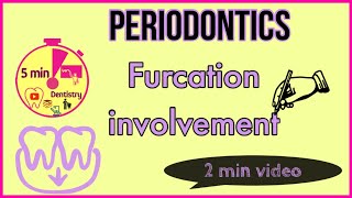 FURCATION INVOLVEMENT  Glickmans classification in 2 minutes  Periodontics [upl. by Mansfield]