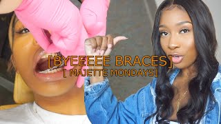 FINALLY GETTING MY BRACES OFF  MAJETTE MONDAYS [upl. by Nilkcaj]