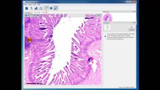 Module 4 Ileum with Peyers Patch [upl. by Belda]