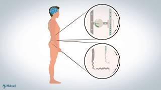 Douleurs neuropathiques et dysfonctionnelles explication [upl. by Eimma]