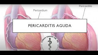 PERICARDITIS AGUDA [upl. by Grosberg118]