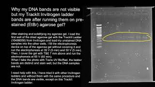 Gel electrophoresis faint bands [upl. by Rusel749]