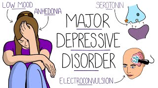 Depression Explained Major Depressive Disorder [upl. by Ramraj]